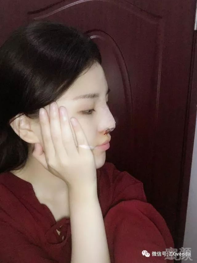 https://img.miyanlife.com/mnt/timg/180311/1154345L3-6.jpg