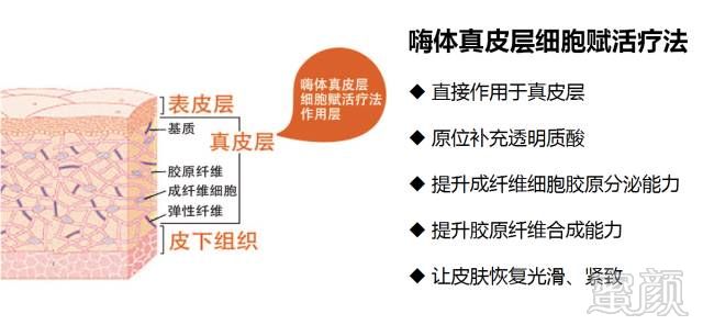 https://img.miyanlife.com/mnt/timg/180311/1204101W4-1.jpg
