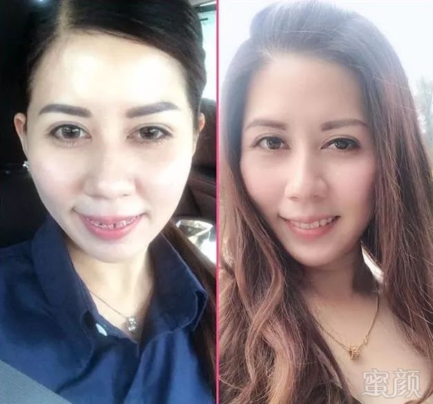 https://img.miyanlife.com/mnt/timg/180311/1205562b9-3.jpg