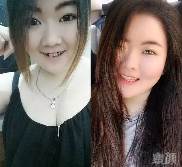 https://img.miyanlife.com/mnt/timg/180311/12055H5T-4.jpg