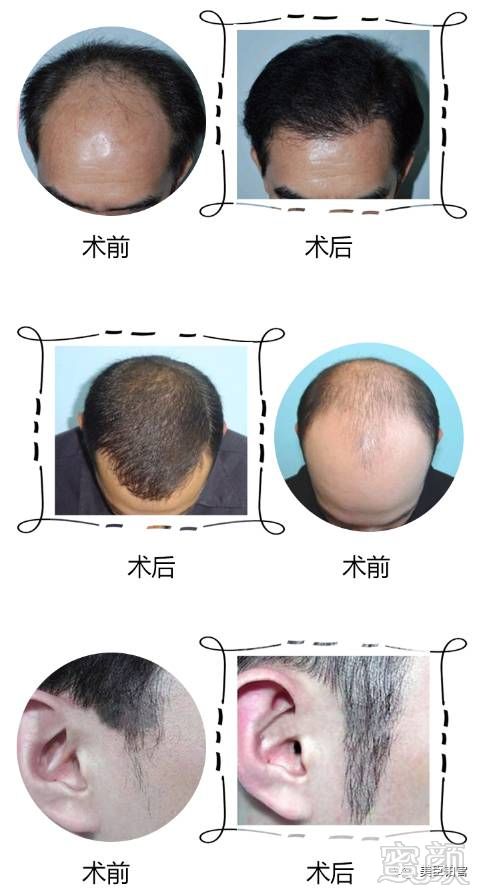 https://img.miyanlife.com/mnt/timg/180311/1213545142-5.jpg