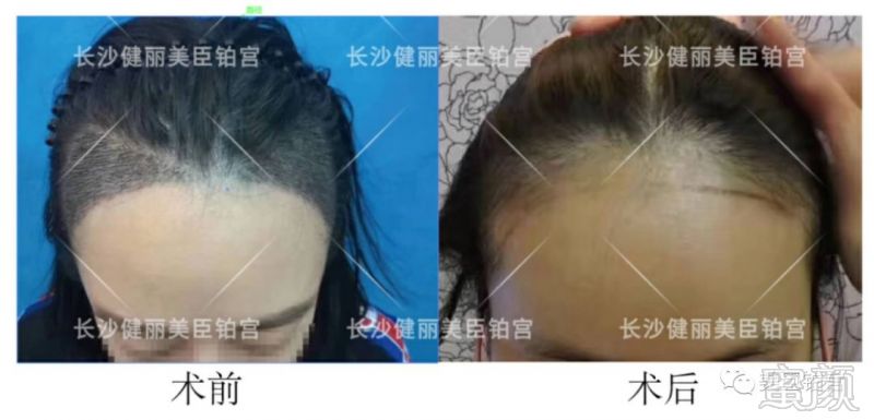 https://img.miyanlife.com/mnt/timg/180311/121355L91-6.jpg