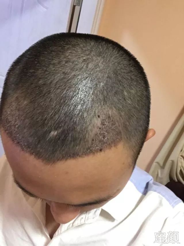 https://img.miyanlife.com/mnt/timg/180311/1220151E9-6.jpg