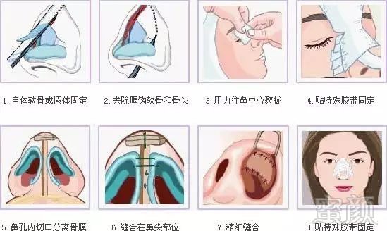 https://img.miyanlife.com/mnt/timg/180311/12363I518-5.jpg