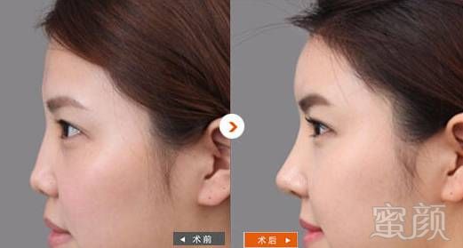 https://img.miyanlife.com/mnt/timg/180311/12363R564-9.jpg