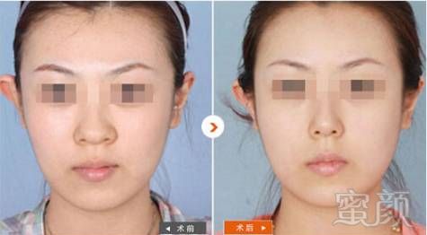 https://img.miyanlife.com/mnt/timg/180311/12363SE9-10.jpg