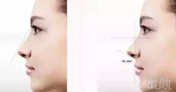 https://img.miyanlife.com/mnt/timg/180311/12363W4V-7.jpg