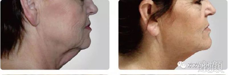 https://img.miyanlife.com/mnt/timg/180312/11395C1H-9.jpg