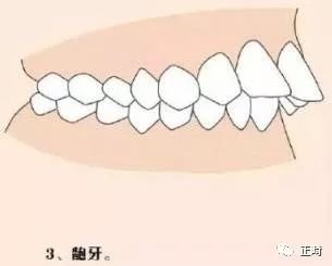 案例图片