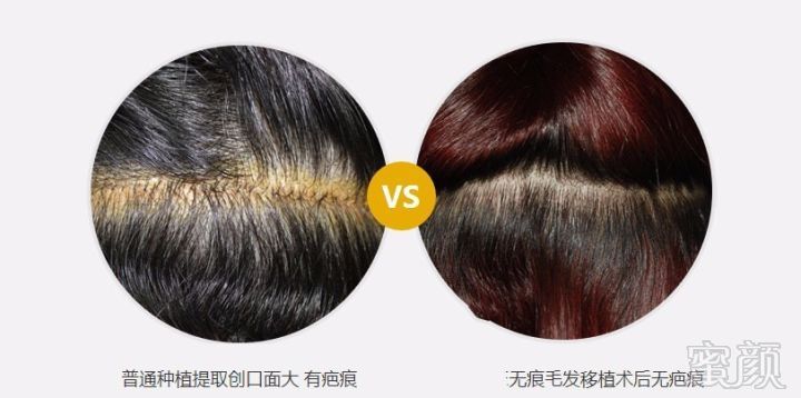 https://img.miyanlife.com/mnt/timg/180312/1144064433-6.jpg
