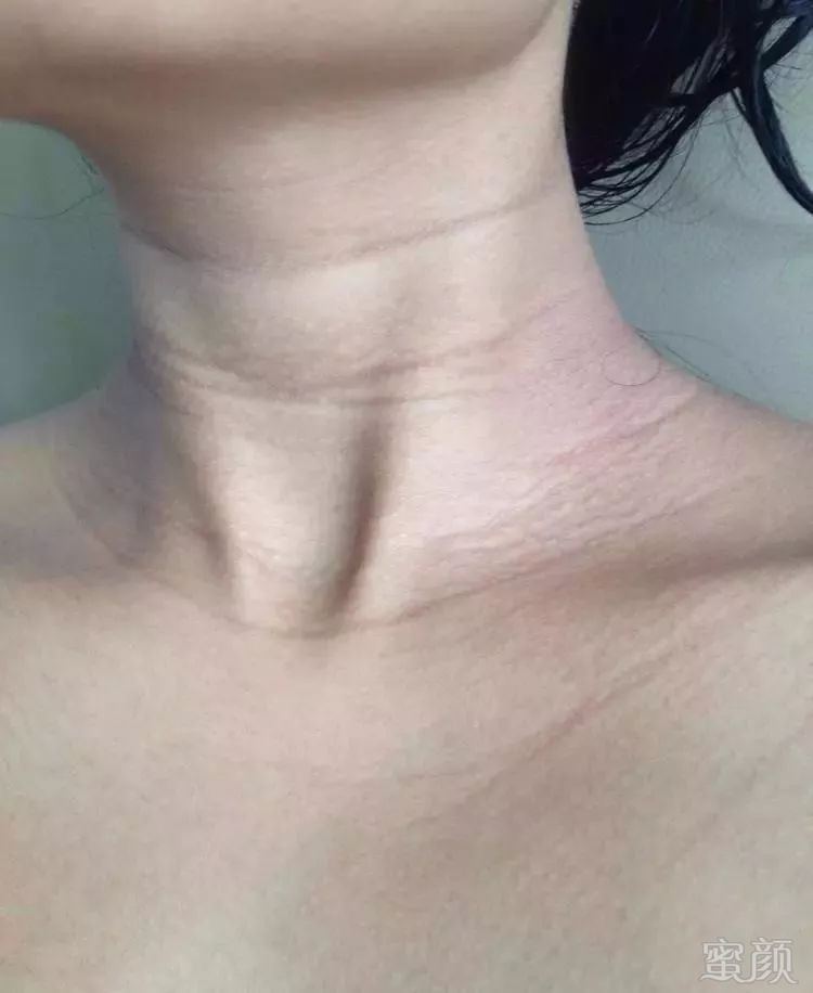 https://img.miyanlife.com/mnt/timg/180312/114R54C6-1.jpg