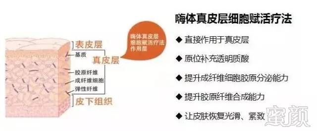 https://img.miyanlife.com/mnt/timg/180312/114RR303-4.jpg