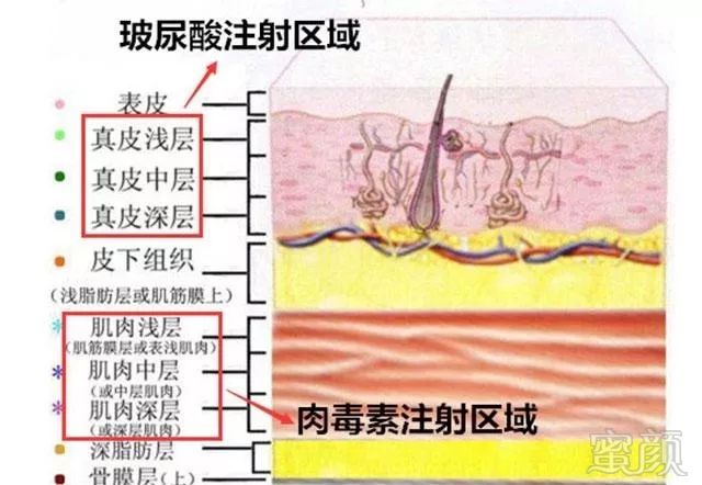 案例图片