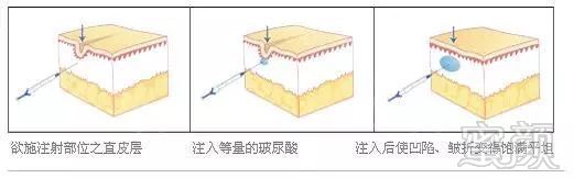 案例图片