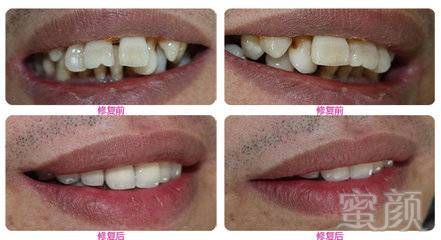 https://img.miyanlife.com/mnt/timg/180312/121F052R-2.jpg