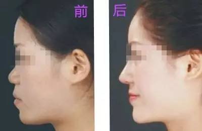 https://img.miyanlife.com/mnt/timg/180312/1233222N8-6.jpg