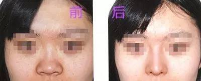 https://img.miyanlife.com/mnt/timg/180312/1233231P9-7.jpg