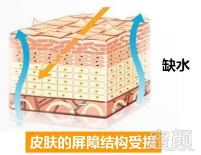 https://img.miyanlife.com/mnt/timg/180312/1233534101-7.jpg