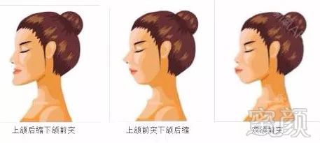 https://img.miyanlife.com/mnt/timg/180312/1235536231-6.jpg