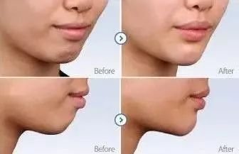 https://img.miyanlife.com/mnt/timg/180312/12355Qa0-11.jpg