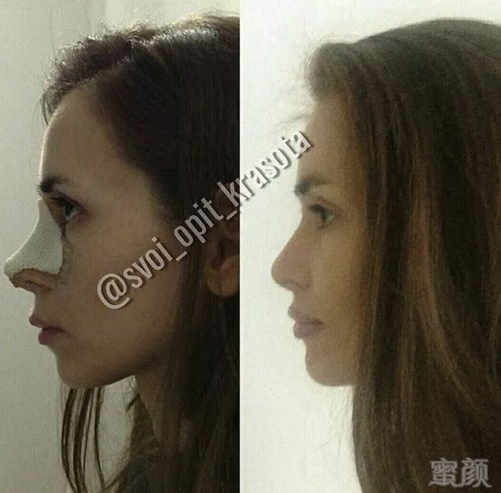 https://img.miyanlife.com/mnt/timg/180312/123G63006-8.jpg