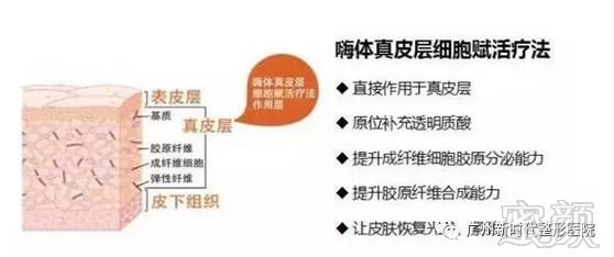 https://img.miyanlife.com/mnt/timg/180312/12444KE1-9.jpg