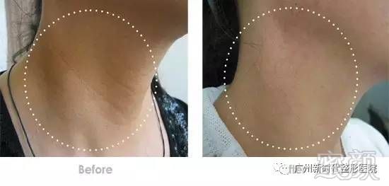 https://img.miyanlife.com/mnt/timg/180312/12444V195-11.jpg