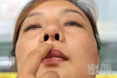 https://img.miyanlife.com/mnt/timg/180312/124AG929-0.jpg