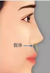 https://img.miyanlife.com/mnt/timg/180312/124AL223-1.jpg