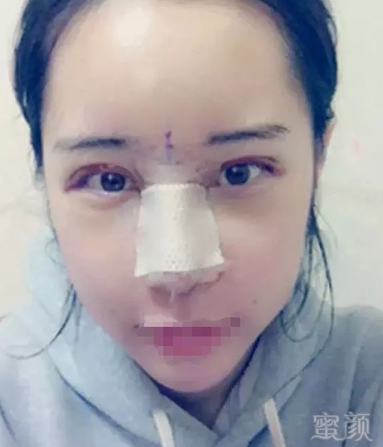 https://img.miyanlife.com/mnt/timg/180313/11163313W-3.jpg