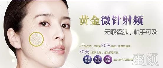https://img.miyanlife.com/mnt/timg/180313/113J41928-2.jpg
