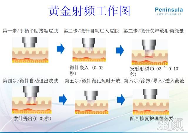 https://img.miyanlife.com/mnt/timg/180313/113JL363-10.jpg