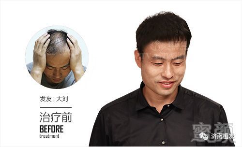 https://img.miyanlife.com/mnt/timg/180313/1151053406-0.jpg