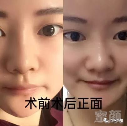 https://img.miyanlife.com/mnt/timg/180313/11554Ba4-1.jpg