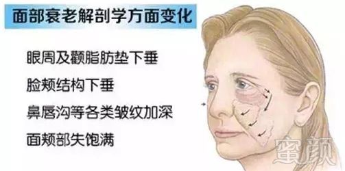 https://img.miyanlife.com/mnt/timg/180313/1156012543-13.jpg