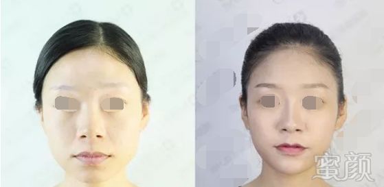 https://img.miyanlife.com/mnt/timg/180313/122222H25-3.jpg