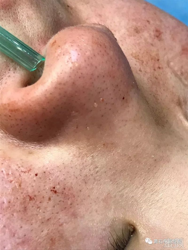 https://img.miyanlife.com/mnt/timg/180313/12411HD8-2.jpg