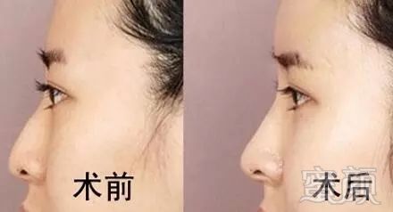 https://img.miyanlife.com/mnt/timg/180313/1332221953-0.jpg