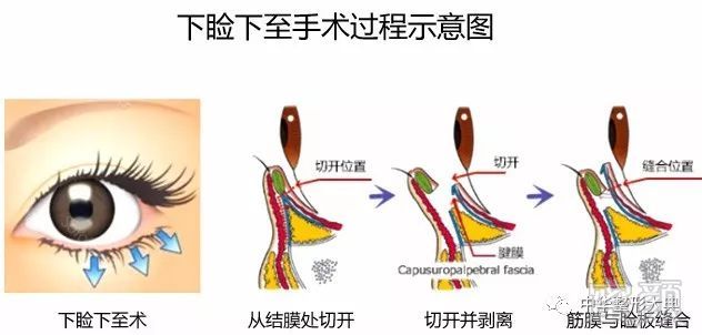 案例图片