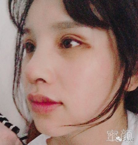 https://img.miyanlife.com/mnt/timg/180314/120RW361-4.jpg