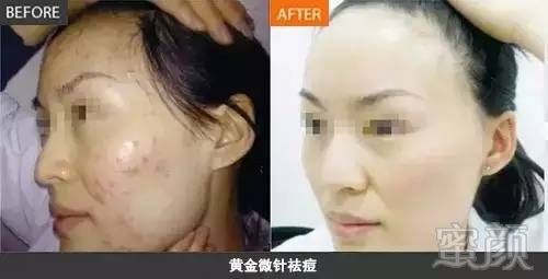 https://img.miyanlife.com/mnt/timg/180314/1329531415-7.jpg