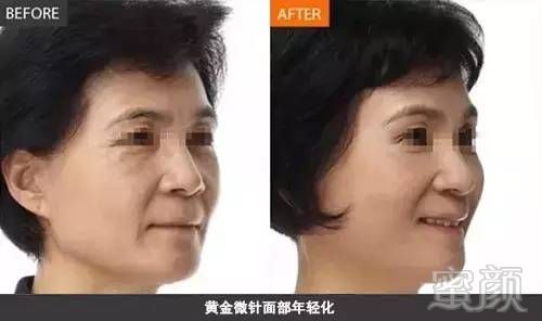 https://img.miyanlife.com/mnt/timg/180314/1329531492-6.jpg