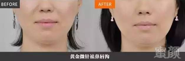 https://img.miyanlife.com/mnt/timg/180314/132954H43-8.jpg