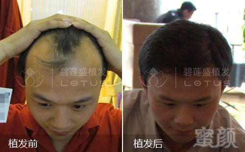 https://img.miyanlife.com/mnt/timg/180314/132H0C39-1.jpg