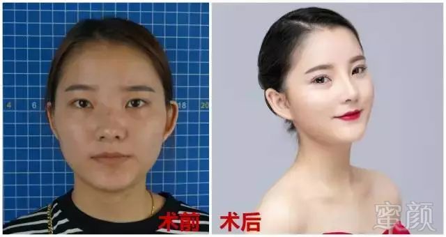 https://img.miyanlife.com/mnt/timg/180314/13353T013-5.jpg