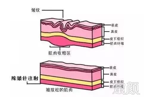 案例图片