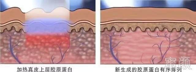 案例图片