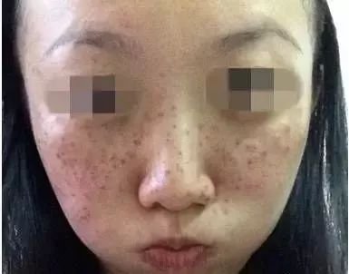 https://img.miyanlife.com/mnt/timg/180314/1434552131-3.jpg