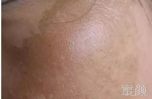 https://img.miyanlife.com/mnt/timg/180314/1434563241-9.jpg