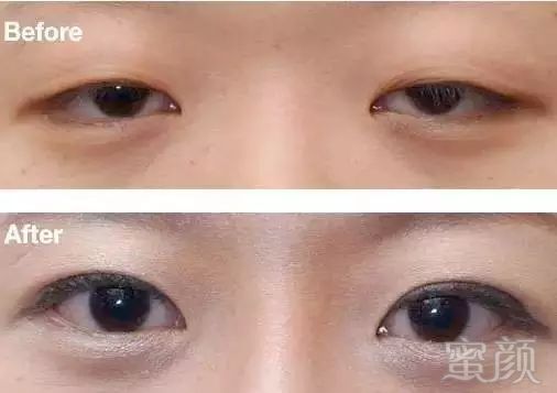 https://img.miyanlife.com/mnt/timg/180314/1443102B0-7.jpg